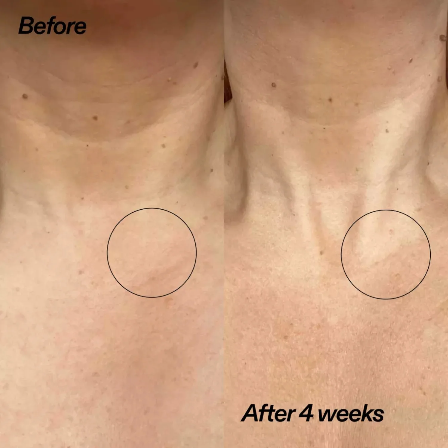 The INKEY List Bio-Active Ceramide Neck Lift Stick 20 g, bild 3