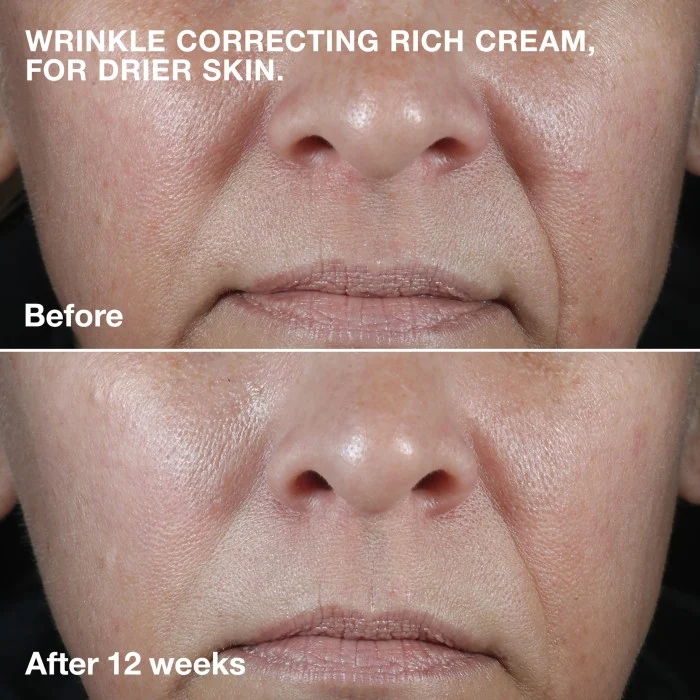 Clinique Smart Clinical Repair Wrinkle Face Cream Rich 50 ml, bild 2
