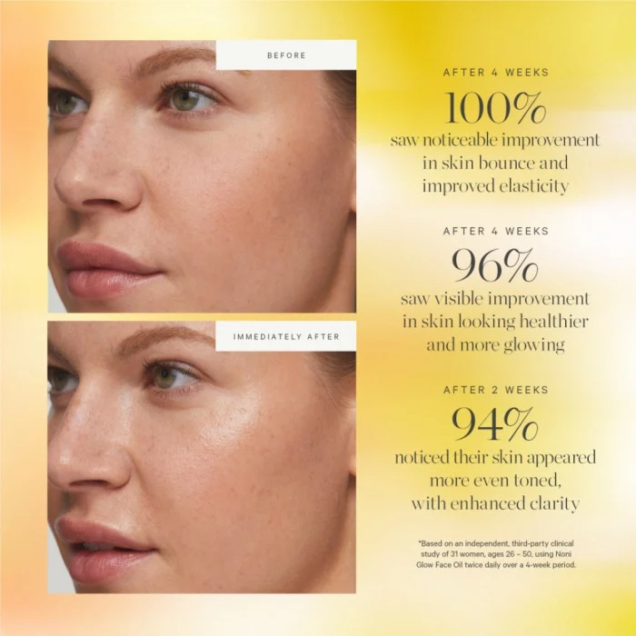 KORA Organics Noni Glow Face Oil 10 ml, bild 3