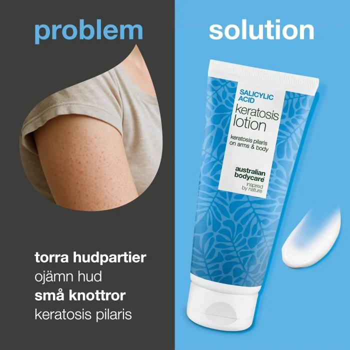Australian Bodycare Salicylic Acid Keratosis Lotion 200 ml, bild 2