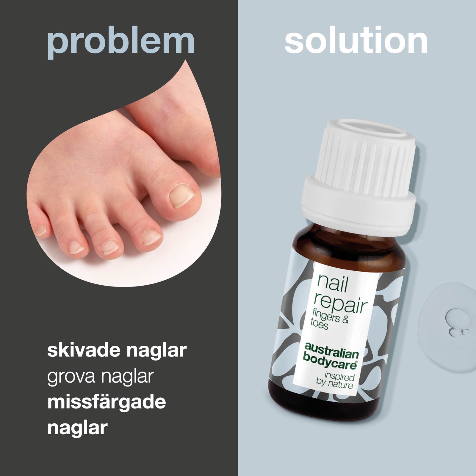 Australian Bodycare Nail Repair 10 ml, bild 2