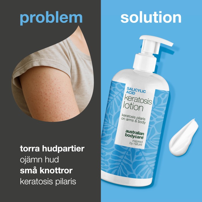 Australian Bodycare Salicylic Acid Keratosis Lotion 500 ml, bild 3